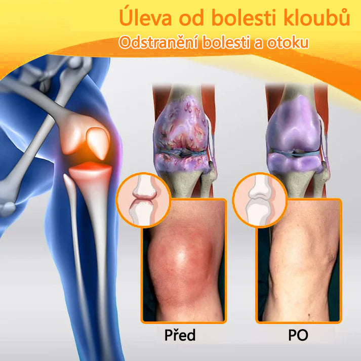 ADNOON™ Krém s botulotoxinem a včelím jedem pro úlevu od bolesti a regeneraci kostí 🐝