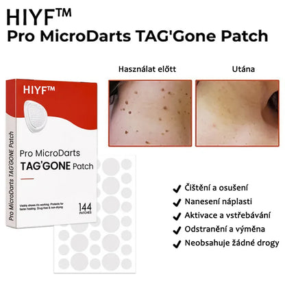 Náplasti na odstranění kožních výrůstků 🛒 KUBOZN® Pro MicroDarts TAG'Gone