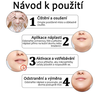 Náplasti na odstranění kožních výrůstků 🛒 KUBOZN® Pro MicroDarts TAG'Gone