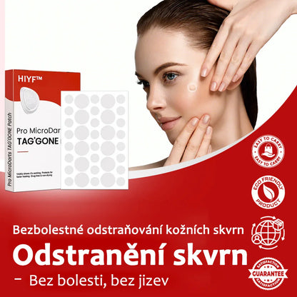 Náplasti na odstranění kožních výrůstků 🛒 KUBOZN® Pro MicroDarts TAG'Gone