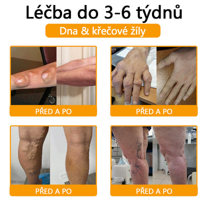 ADNOON™ Krém s botulotoxinem a včelím jedem pro úlevu od bolesti a regeneraci kostí 🐝