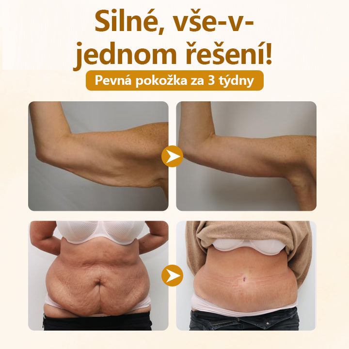 Timilk®✅ Krém na opravu s komplexem včelího jedu
