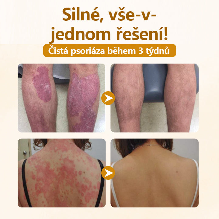 Timilk®✅ Krém na opravu s komplexem včelího jedu