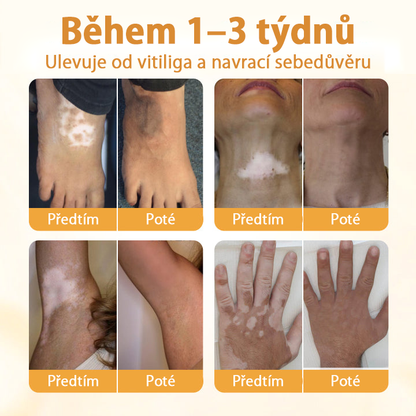 Timilk® VitiCalm krém s včelím jedem🎁