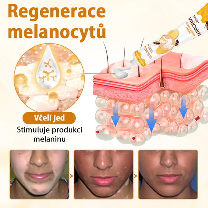 Timilk® VitiCalm krém s včelím jedem🎁