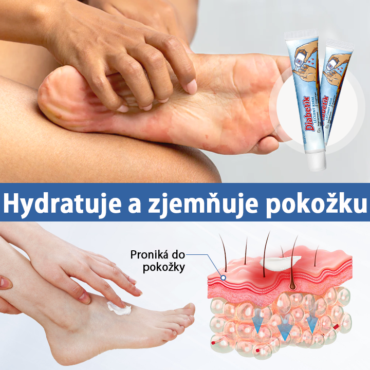 Biancat® VitaGluco krém pro péči o diabetickou nohu