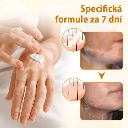 Timilk® VitiCalm krém s včelím jedem🎁