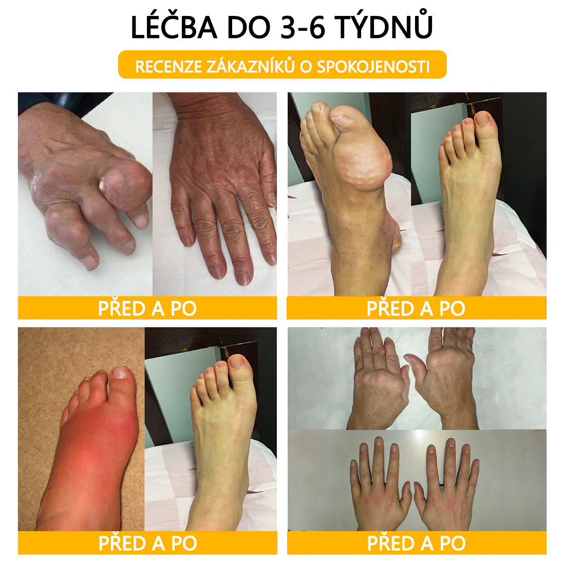 ADNOON™ Krém s botulotoxinem a včelím jedem pro úlevu od bolesti a regeneraci kostí 🐝